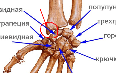 Кости запястья полулунная. Ладьевидная кость запястье перелом. Анатомия ладьевидной кости кисти. Ладьевидная кость лучезапястного сустава. Полулунная кость кисти перелом.